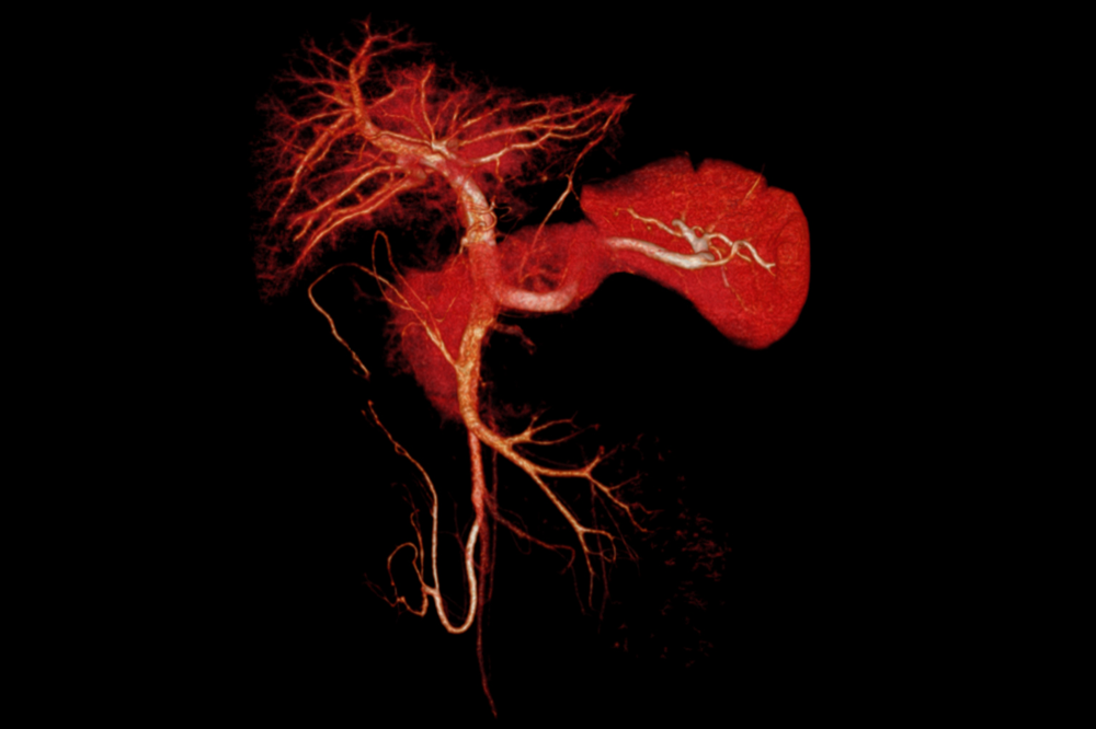 cta-abdomen